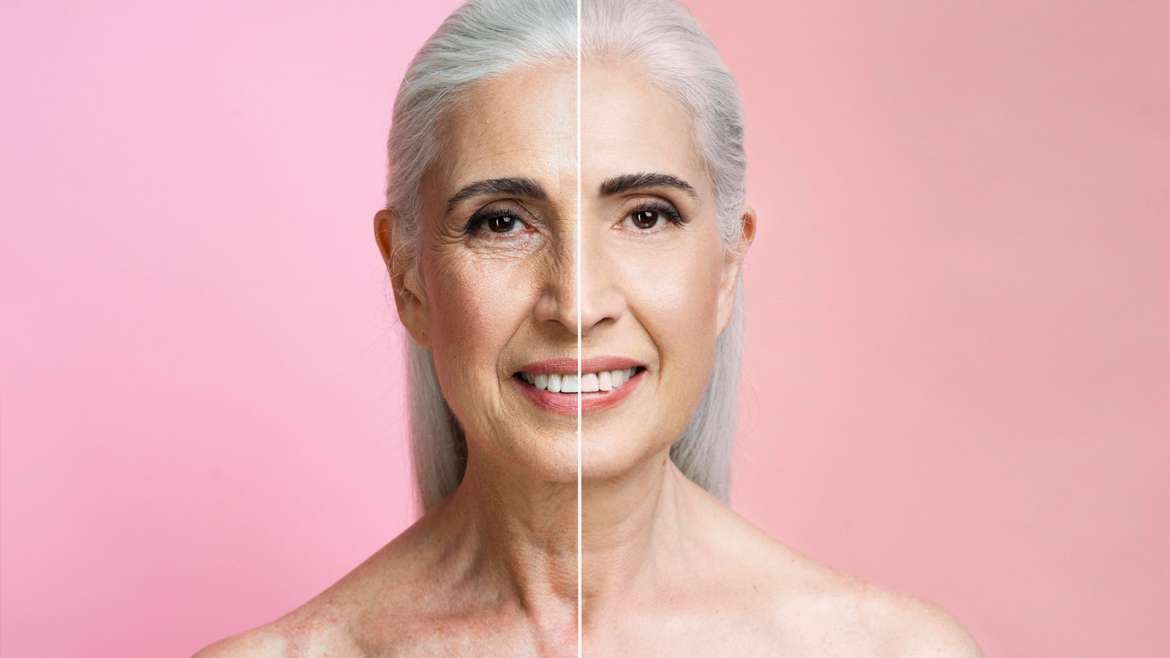 Bioestimuladores de Colágeno