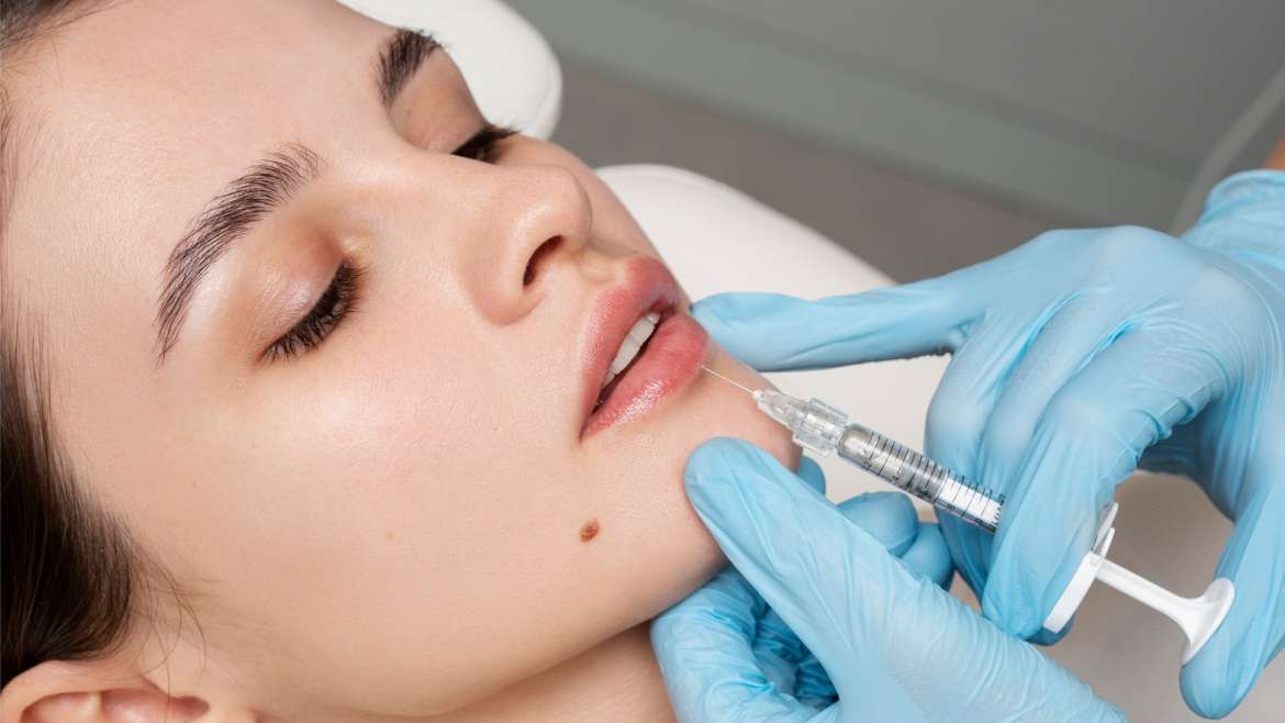 Preenchimento Labial